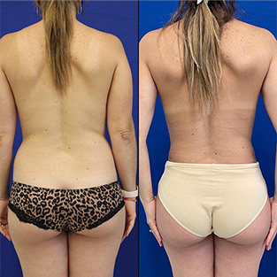 after/before