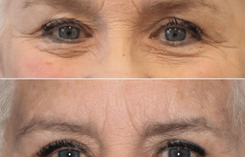 Patient Before and After