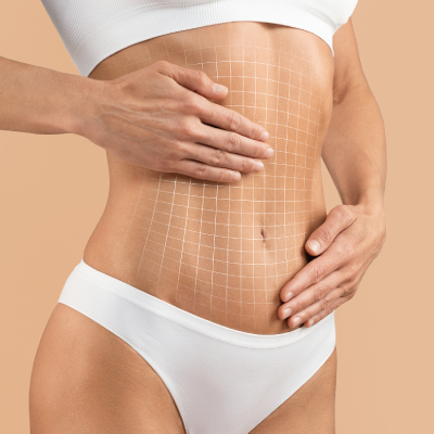 tummy tuck female