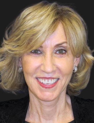 after Facelift & Neck Lift (Custom Facial Rejuvenation)