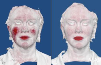 Digital 3D scans of a person's face and upper torso are shown side by side against a blue background, with the MAIA logo in the lower right corner.