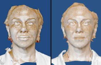 Digital 3D scans of a person's face and upper torso are shown side by side against a blue background, with the MAIA logo in the lower right corner.