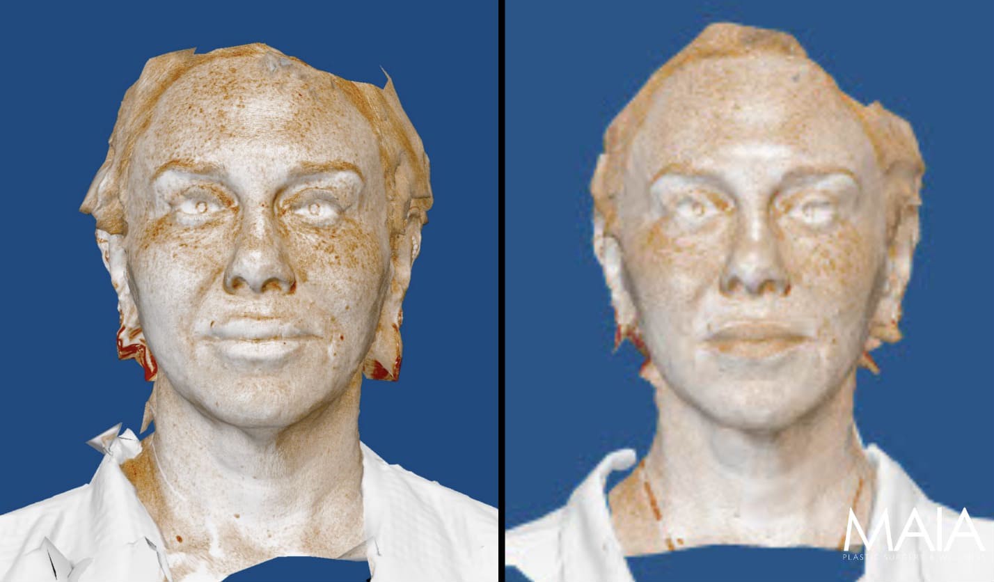 Digital 3D scans of a person's face and upper torso are shown side by side against a blue background, with the MAIA logo in the lower right corner.