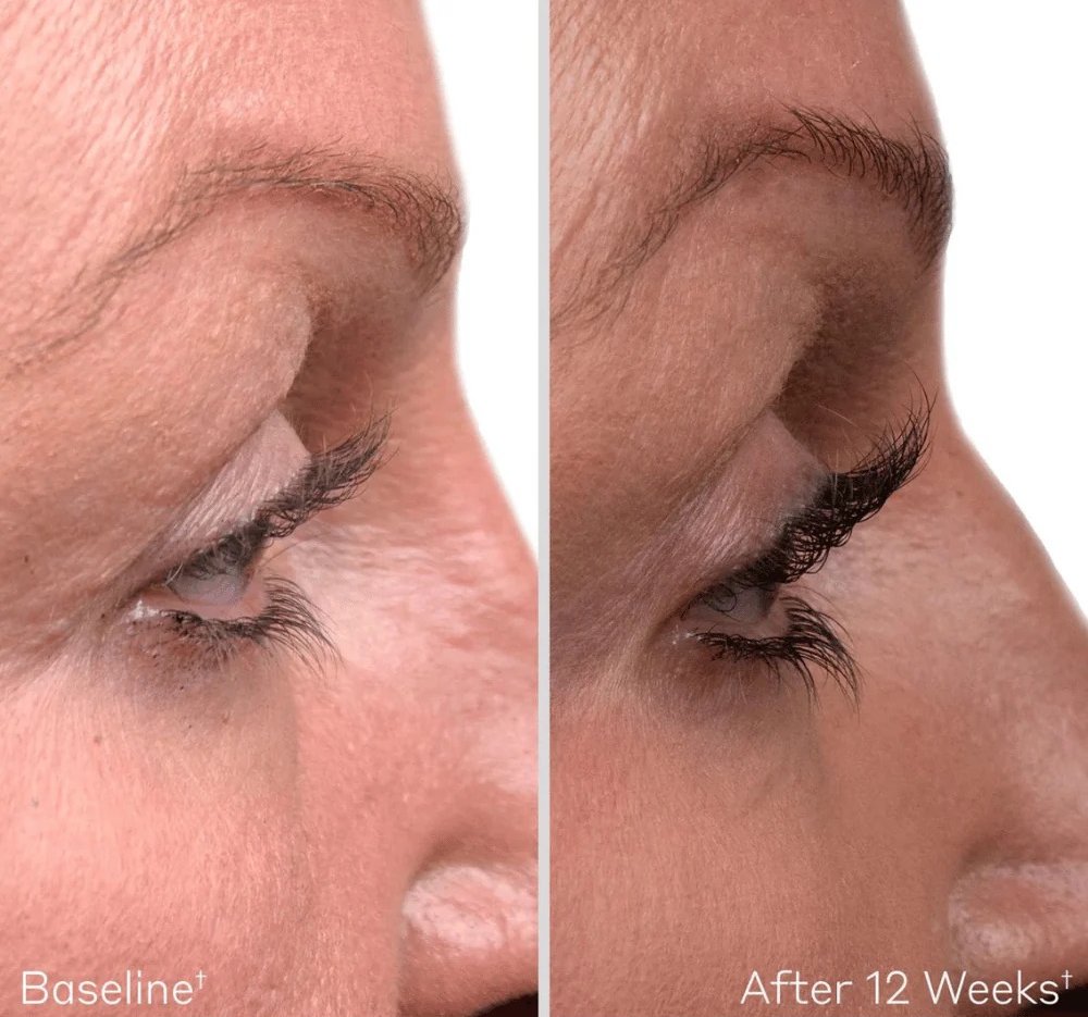 Side-by-side comparison showing eyelashes before and after consistent use of Eyelash Enhancing Serum, highlighting visibly fuller, longer, and healthier lashes over time.
