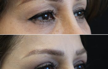 Close-up before and after comparison of a woman's eyebrows and eyelids, showing cosmetic enhancement with improved eyebrow shape and makeup.