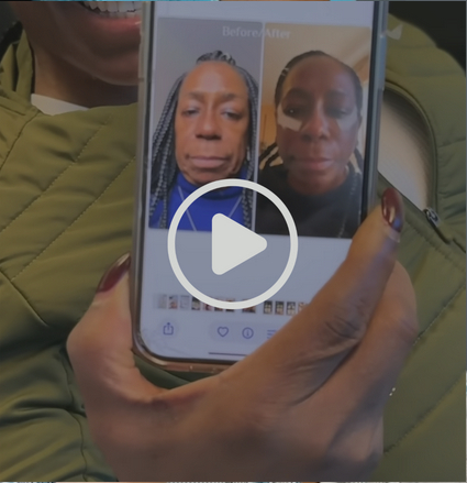 Patient 3 weeks after comprehensive facial rejuvenation, video play icon visible.