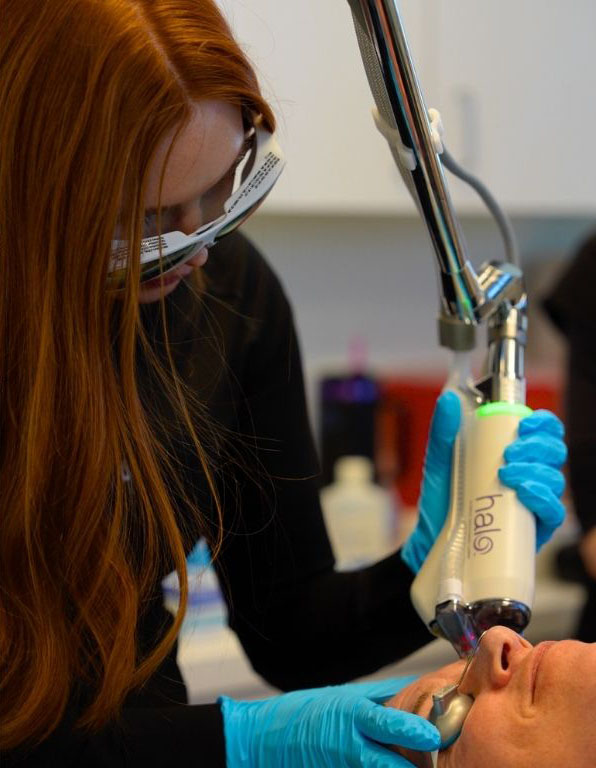 patient during halo Laser