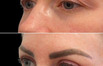Side-by-side close-up of a person's face showing eyebrows before (top) and after (bottom) cosmetic enhancement; noticeable difference in eyebrow color and shape.