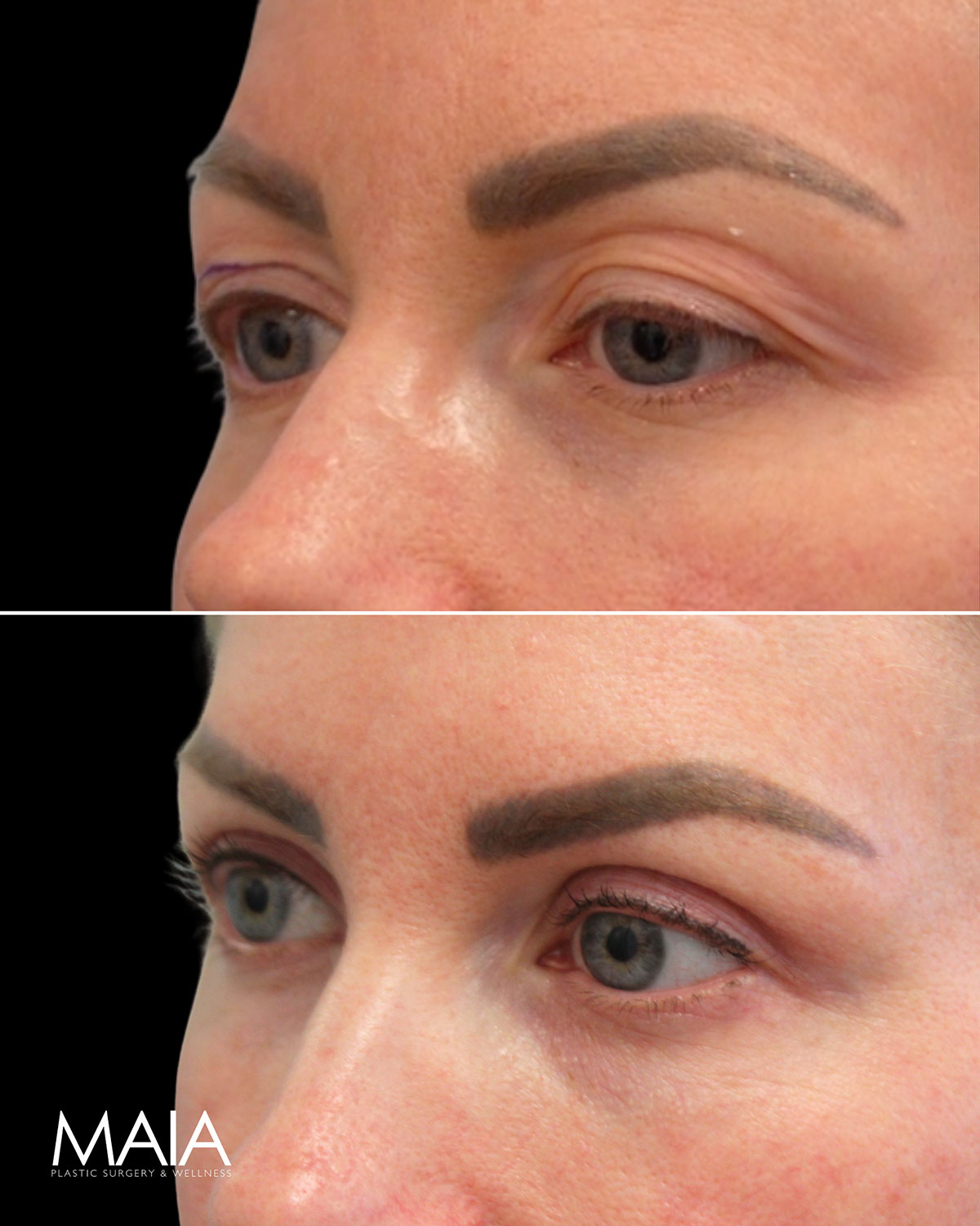 Side-by-side close-up of a person's face showing eyebrows before (top) and after (bottom) cosmetic enhancement; noticeable difference in eyebrow color and shape.