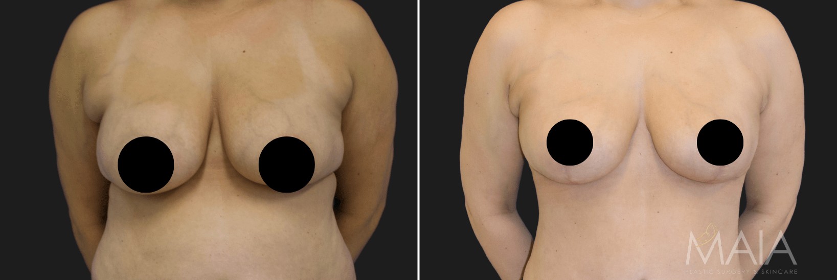 patient before and after procedure